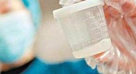 高龄做三代试管费用揭秘，哪些因素决定最终花费？