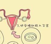 韶关试管婴儿生多胎要多少钱？各项花销尽收眼底